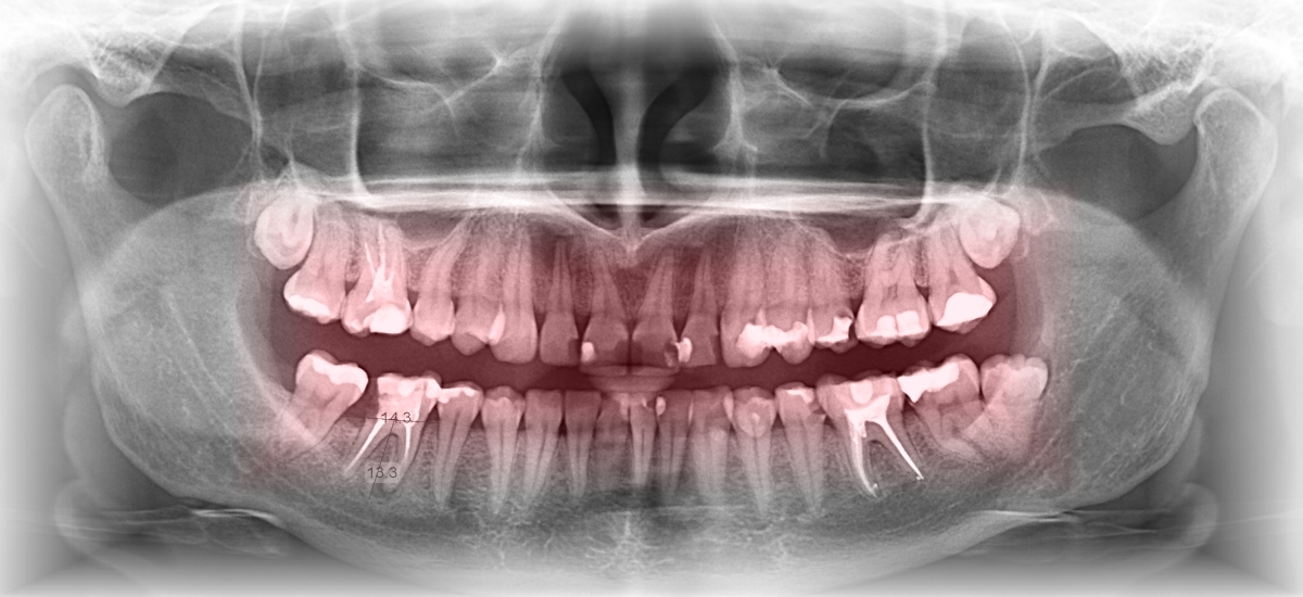 Zabiegi chirurgiczne, gabinet dentystyki Dental Pearl