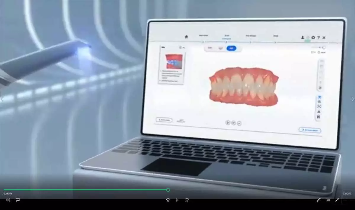 Komputerowe projektowanie uśmiechu w Dental Pearl Mikołów