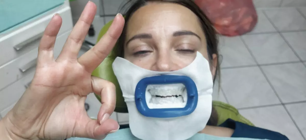 Skanowanie wewnątrzustne 3D jamy ustnej
